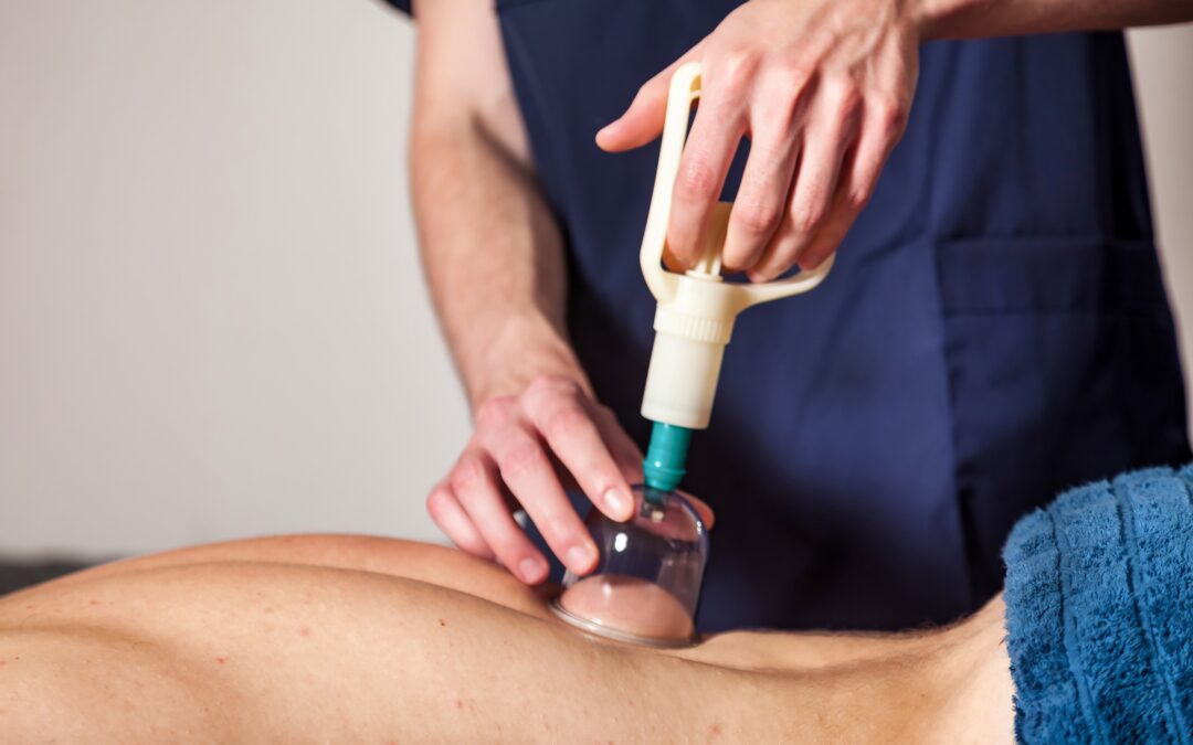 Βεντούζες (Cupping)